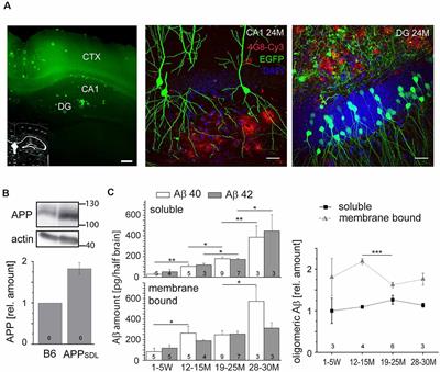 Chronic Presence of Oligomeric Aβ Differentially Modulates Spine Parameters in the Hippocampus and Cortex of Mice With Low APP Transgene Expression